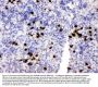 Anti-MRP8/S100A8 Antibody Picoband®