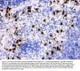 Anti-MRP8/S100A8 Antibody Picoband®