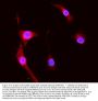Anti-MRP8/S100A8 Antibody Picoband®