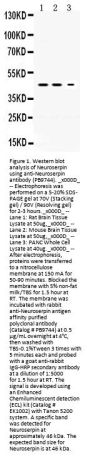 Anti-Neuroserpin/SERPINI1 Antibody Picoband®