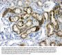 Anti-Prealbumin/TTR Antibody Picoband®