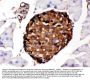 Anti-Prealbumin/TTR Antibody Picoband®