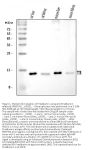 Anti-Prealbumin/TTR Antibody Picoband®
