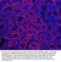 Anti-Prealbumin/TTR Antibody Picoband®