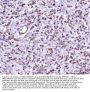 Anti-MEK7/MAP2K7 Antibody Picoband®