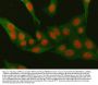 Anti-Mineralocorticoid Receptor/NR3C2 Antibody Picoband®