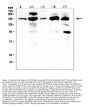 Anti-PDGF Receptor alpha/PDGFRA Antibody Picoband®