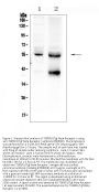 Anti-TGF beta Receptor I/TGFBR1 Antibody Picoband®