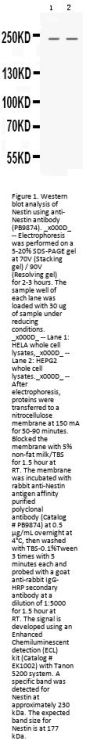 Anti-Nestin Antibody Picoband®