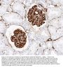 Anti-Nestin Antibody Picoband®