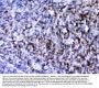 Anti-CD2/CD2 Antibody Picoband®