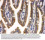 Anti-CDCP1 Antibody Picoband®