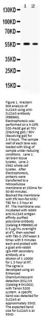Anti-Glucose Transporter 5 GLUT5/SLC2A5 Antibody Picoband®