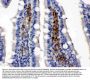 Anti-Glucose Transporter 5 GLUT5/SLC2A5 Antibody Picoband®
