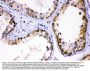 Anti-AMHR2 Antibody Picoband®