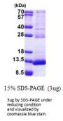 Human TSTD3 Recombinant Protein