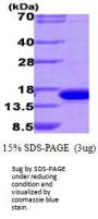 Human Galectin9 Recombinant Protein