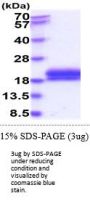 Human TNFRSF10A Recombinant Protein