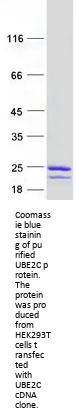UBE2C (NM_181801) Human Recombinant Protein