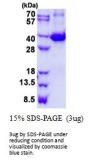 Mouse Galectin-9 Recombinant Protein