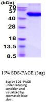 Mouse Osteoprotegerin/TNFRSF11B Recombinant Protein