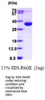 Human CCS Recombinant Protein