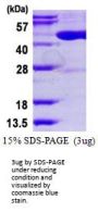 Human TRDMT1 Recombinant Protein