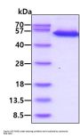 Human TRAIL R2/TNFRSF10B Recombinant Protein