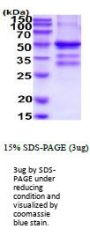 Human TACI/TNFRSF13B Recombinant Protein