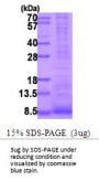 Human Epiregulin Recombinant Protein