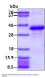Human Survivin Recombinant Protein