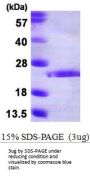 Human FGF-10 Recombinant Protein