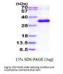 Human Kallikrein 10 Recombinant Protein