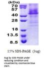 Human HOXC11 Recombinant Protein