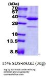 Human AMPK beta 2 Recombinant Protein