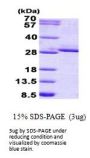 Human FGF-17 Recombinant Protein