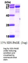 Human NMT2 Recombinant Protein