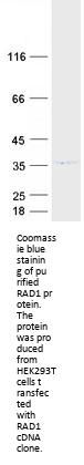 RAD1 (NM_002853) Human Recombinant Protein