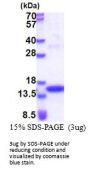 Human JAK2 Recombinant Protein