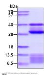 Mouse Ctss Recombinant Protein