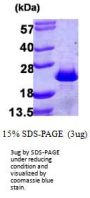 Human PDCD6 Recombinant Protein