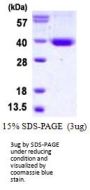 Human STX11 Recombinant Protein