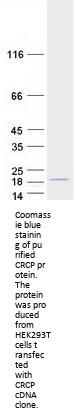 CRCP (NM_001040647) Human Recombinant Protein