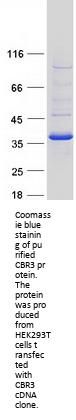 CBR3 (NM_001236) Human Recombinant Protein