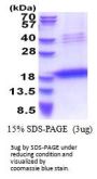 Human LECT1 Recombinant Protein