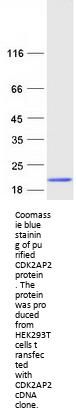 CDK2AP2 (NM_005851) Human Recombinant Protein