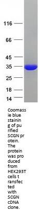 SCGN (NM_006998) Human Recombinant Protein