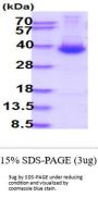 Human Dkk-1 Recombinant Protein