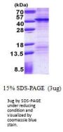 Human FSBP Recombinant Protein