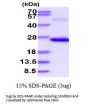Human TL1A/TNFSF15 Recombinant Protein